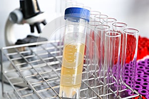 Urine test to look for abnormalities from Urine, Urine sample to analyze in the laboratory