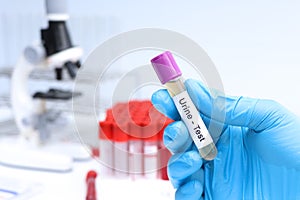 Urine test to look for abnormalities from Urine, Urine sample to analyze in the laboratory