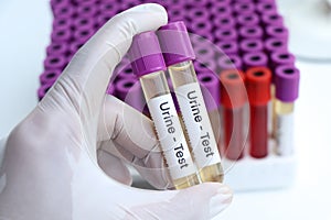 Urine test to look for abnormalities from Urine, Urine sample to analyze in the laboratory