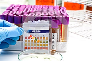 Urine and universal indicator paper, Litmus Paper of ph Value Measurement