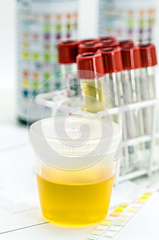 Urine vial in laboratory, toxicology or routine examination