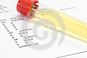 Urine vial in laboratory, toxicology or routine examination photo