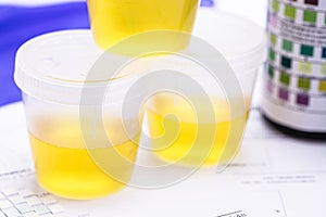 Urine vial in laboratory, toxicology or routine examination, vials with urine for laboratory examination