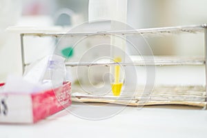 Urine yellow in tube.