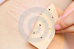 Using chinese rheumatism plaster