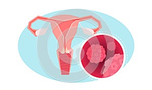 an uterus, fallopian tubes and ovaries