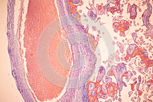 Uterus human, Uterine tube human, Placenta human and Umbilical cord Human under the microscope.