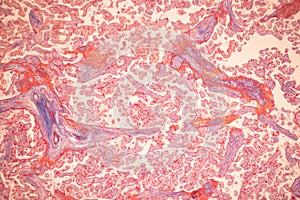 Uterus human, Uterine tube human, Placenta human and Umbilical cord Human under the microscope.