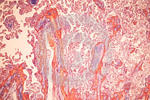 Uterus human, Uterine tube human, Placenta human and Umbilical cord Human under the microscope.