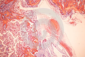 Uterus human, Uterine tube human, Placenta human and Umbilical cord Human under the microscope.