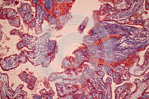 Uterus human, Uterine tube human, Placenta human and Umbilical cord Human under the microscope.