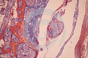 Uterus human, Uterine tube human, Placenta human and Umbilical cord Human under the microscope.