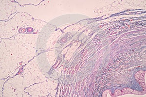 Uterus human, Uterine tube human, Placenta human and Umbilical cord Human under the microscope.