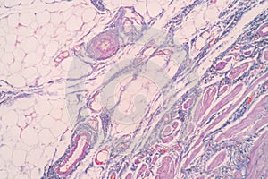 Uterus human, Uterine tube human, Placenta human and Umbilical cord Human under the microscope.