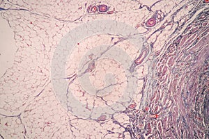 Uterus human, Uterine tube human, Placenta human and Umbilical cord Human under the microscope.