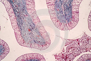 Uterus human, Uterine tube human, Placenta human and Umbilical cord Human under the microscope.