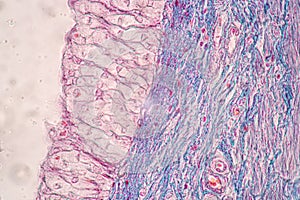 Uterus human, Uterine tube human, Placenta human and Umbilical cord Human under the microscope.