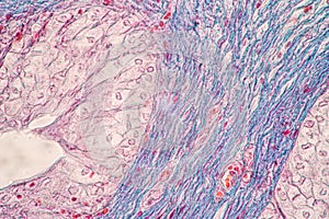 Uterus human, Uterine tube human, Placenta human and Umbilical cord Human under the microscope.