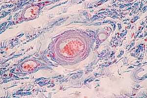 Uterus human, Uterine tube human, Placenta human and Umbilical cord Human under the microscope.