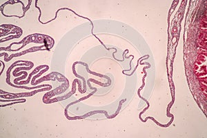 Uterus human, Uterine tube human, Placenta human and Umbilical cord Human under the microscope.