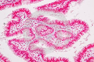 Uterus human, Uterine tube human, Placenta human and Umbilical cord Human under the microscope.