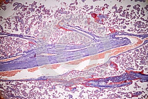 Uterus human, Uterine tube human, Placenta human and Umbilical cord Human under the microscope.