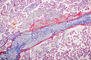 Uterus human, Uterine tube human, Placenta human and Umbilical cord Human under the microscope.