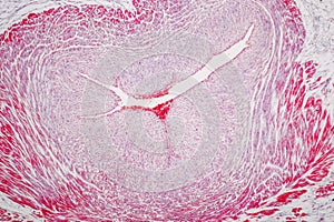 Uterus human, Uterine tube human, Placenta human and Umbilical cord Human under the microscope.