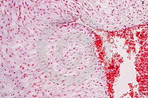 Uterus human, Uterine tube human, Placenta human and Umbilical cord Human under the microscope.