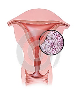 Uterus - Menstrual Pain photo