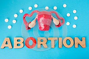 Uterus model with pills as medical abortion concept photo . 3D figure of uterus with ovaries is on blue background with crumbled p photo