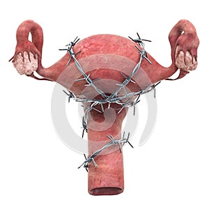 Uterus Pain concept. Human uterus with barbed wire. 3D rendering