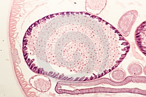 Uterus of parasitic nematode worm