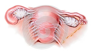 Uterus - Pelvic Inflammatory Disease PID