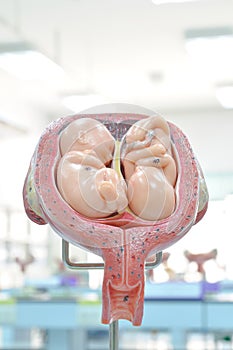 Uterus with twin fetus photo