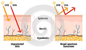 UV penetration into the layers of the skin. Infographic of sunscreen protection against UVA, UVB rays. Skin anatomy. Broad-