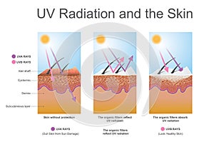 Záření a kůže 
