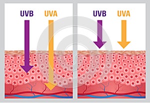 UV , uv a and uv b protection