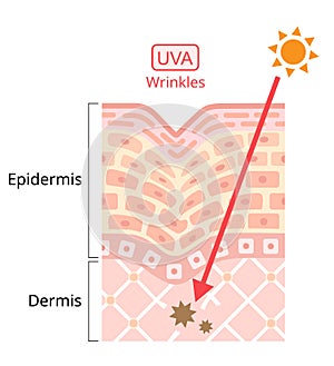 UVA damages to human skin. Beauty and heath care concept