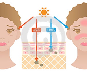 Infographic skin illustration. the difference between UVA and UVB rays penetration photo