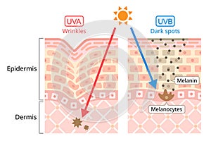 UVA and UVB damages to human skin. Beauty and heath care concept