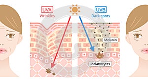 UVA and uvb penetrate into the skin on woman\'s face. beauty and health care concept