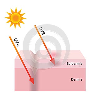 UVA and UVB radiation penetrate into the skin