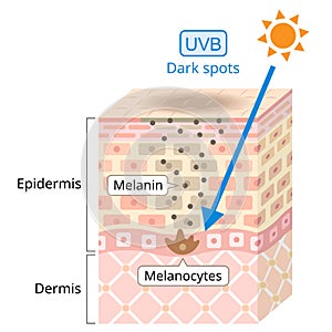 UVB radiation penetrate into the skin. Beauty and heath care concept