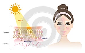 UVB rays penetrate into the skin layer and damage woman face vector on white background.