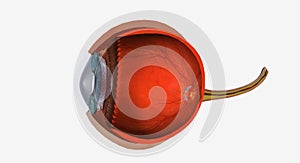 Uveitis is swelling and irritation of the uvea, the middle layer