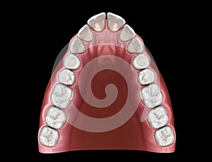 V-shape tapered arch form of maxilla. Medically accurate tooth 3D illustration