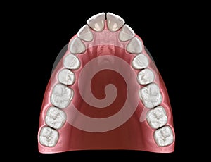 V-shape tapered arch form of maxilla. Medically accurate tooth 3D illustration photo