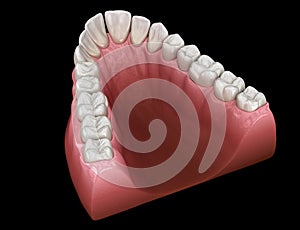 V-shape tapered arch form of maxilla. Medically accurate tooth 3D illustration photo