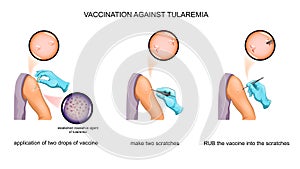 Vaccination against tularemia